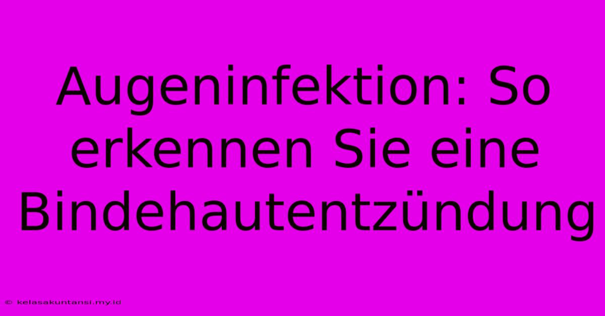 Augeninfektion: So Erkennen Sie Eine Bindehautentzündung Augeninfektion: So Erkennen Sie Eine Bindehautentzündung